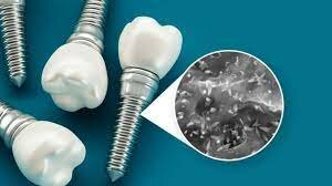 Nanotecnología en odontologia