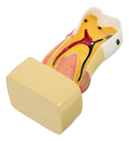 2013 Carie-ozon se distribuye en México, contiene papaína y bromelina.