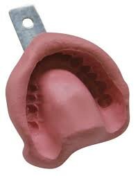 Técnica de impresión con hidrocoloide para incrustaciones y puentes fijos.