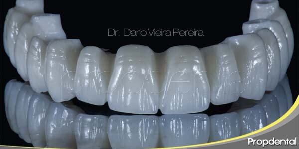 Se introduce al mercado la porcelana aluminosa