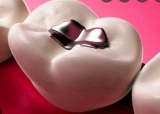 Innovación a la Amalgama