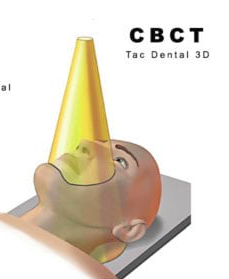 Aparición del CBCT