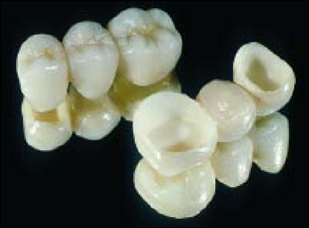 Dr. Matts Anderson y Agneta Oden diseñan el sistema Procera