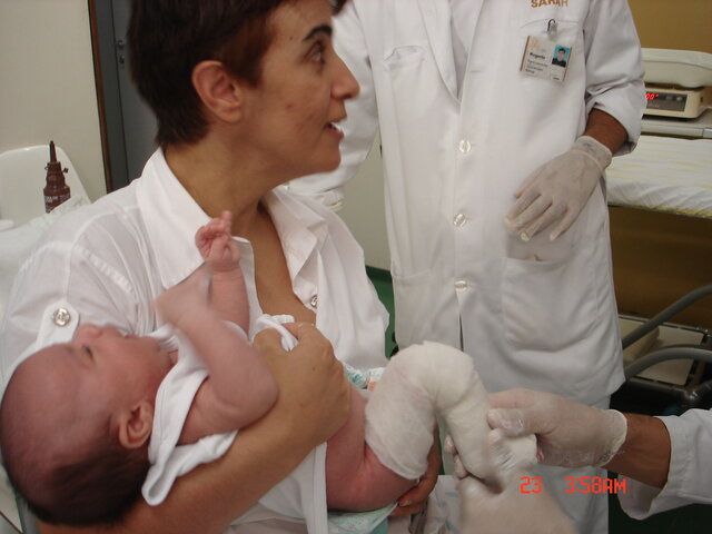 Colocando gesso para corrigir meu pé torto