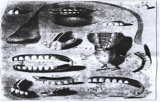 El Alemán Pfaff desarrolló una técnica que permitió que los dientes de porcelana se utilizaran eficazmente en construcción de la base de la dentadura postiza.
