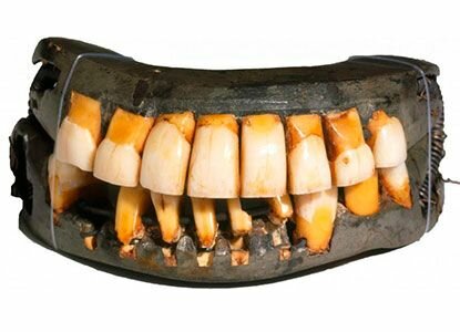 El Dr. Charles Land patentó las primeras coronas de cerámica.