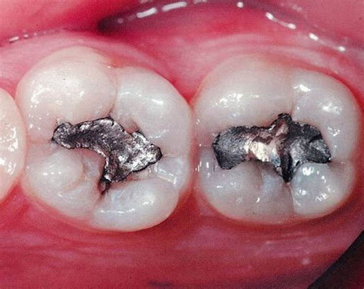 Innovación a la amalgama