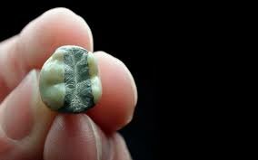 Se invento amalgama dental.