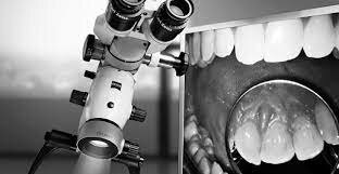 Introduccion de microscopio quirúrgico dental en odontología.