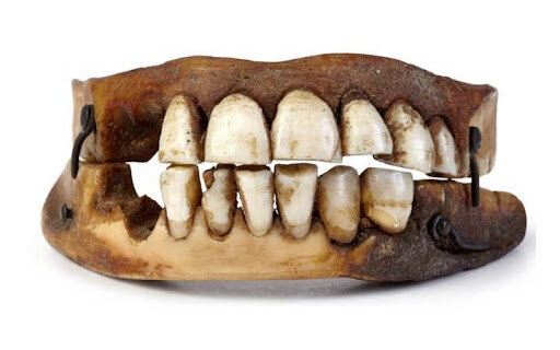 Uso de cerámica para dentadura completa