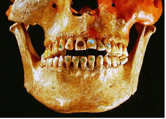 Inicio de la odontologia.