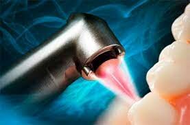 Desarrollaron el láser. Y se aprobó su uso como tratamiento para el tejido suave, como de enfermedades periodontales.