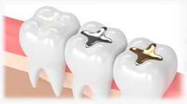 Timeline: Actividad 1. Historia de la Odontología Restauradora