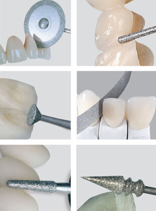 Se introducen instrumentos modernos.