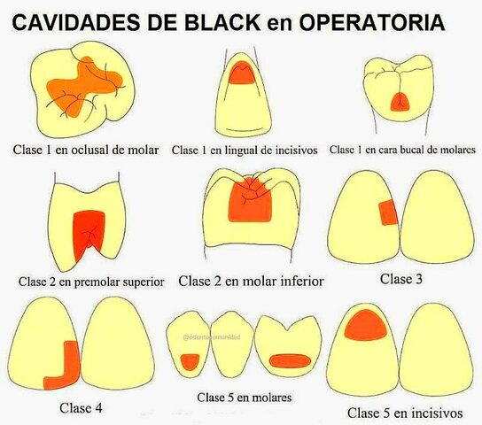 Black publicó su sistema.