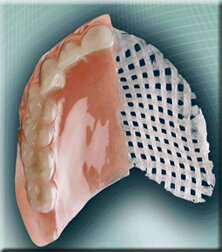 Empezaron reforzar  las dentaduras postizas.