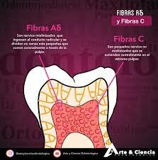 Uso de haces de fibras preimpregnados.