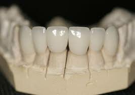 Introducción la zirconia In-Ceram.