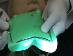 Uso de dique de goma