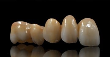 Introducción de la zirconia In-Ceram.