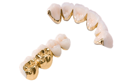 Investigación sobre porcelana y oro