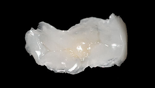 Cerómeros (resinas compuestas reforzadas con partículas de cerámica)