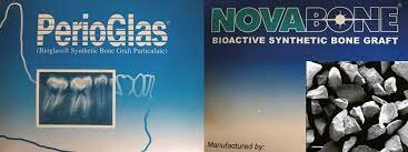 Bioglass particulado para el injerto ortopédico de hueso fue introducido en el mercado europeo en 1999, bajo el tratado llamado NovaBone