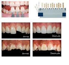Introducción de los Ormocres