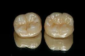 Introducción de cerámica de zirconia