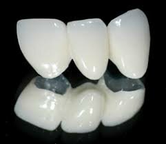 Las primeras resinas a presión entran al mercado, permitiendo así tener restauraciones libres de metal