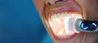 El sistema de aislamiento bucal “Isolite” es desarrollado y combina las funciones de luz, succión y retracción en un solo dispositivo