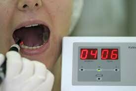 La fluorescencia láser (DIAGNOdent) fue presentada en el mercado para la detección de caries oclusales