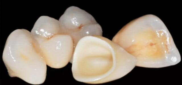 Zirconia