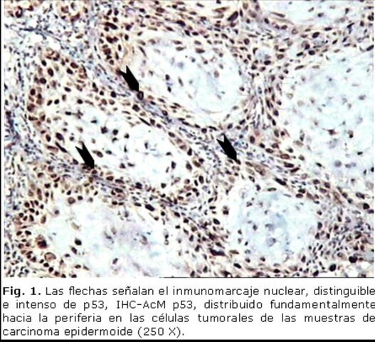 David Philip Lane Descubridor de la proteína p53