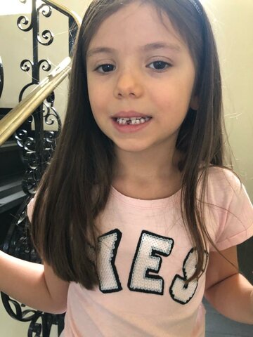 Meu primeiro dente que caiu....