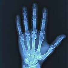 Discoveries About How X-Rays Effect Human Cells
