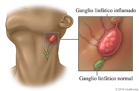 GANGLIOS.