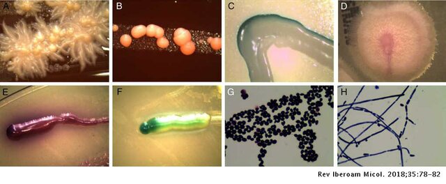 DESCUBREN MICROORGANISMOS EN CONDUCTOS