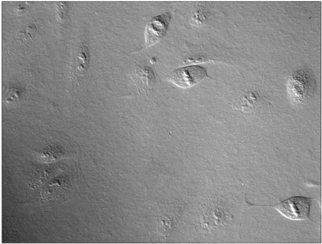 Aplicaciones del M. de contraste por interferencia diferencial