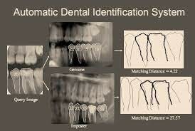 Dental x-ray Matching System