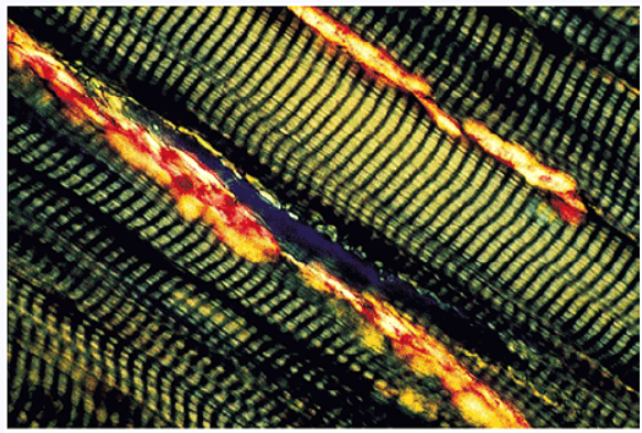 Aplicaciones del M. de luz polarizada