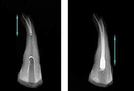 EXÁMEN BACTERIOLOGICO RADICULAR