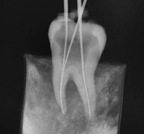 RX PARA CONDUCTOMETRÍA