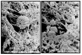 FOCO DE INFECCIÓN ARTIFICIAL