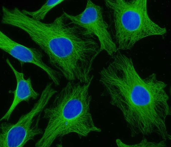 Microscopio confocal