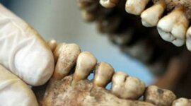 Timeline: Evolución de la odontológica