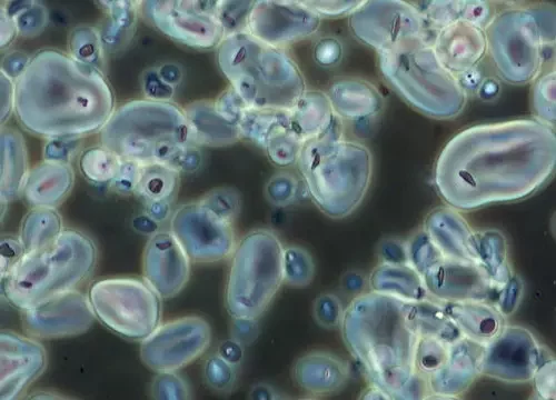 Microscopio invertido