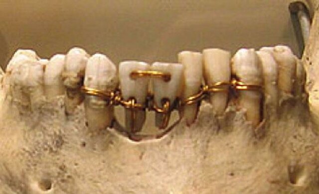 Etruscos