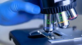 Timeline: Tipos de microscopio