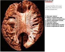 Disección de los encéfalos, hipótesis cerebral.